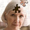 Впервые выявлены случаи заражения болезнью Альцгеймера