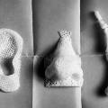 Российские ученые создали искусственные кости, подходящие любому человеку