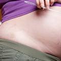 Диабет у беременных повышает риск серьезных патологий плода