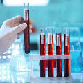 Учёные научились определять продолжительность жизни человека по анализу крови